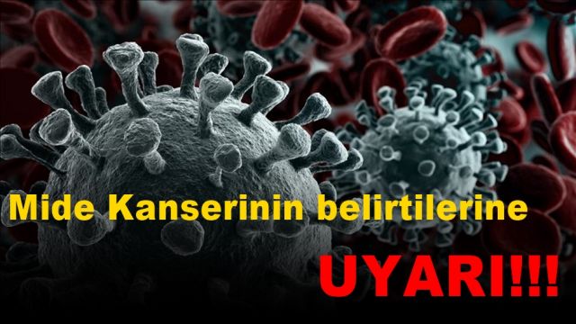 Uzmanından mide kanserinin sinsi belirtilerine karşı uyarı